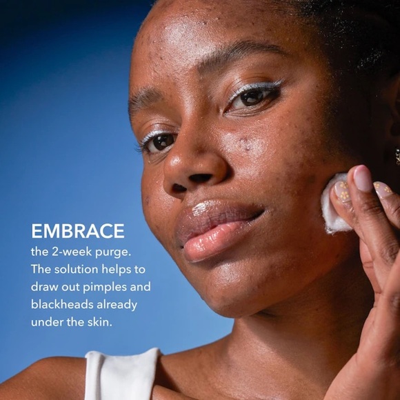 🆕 DR DENNIS GROSS Skincare Alpha Beta® 2% BHA + Breakout Solution 150 mL NWOB - Picture 11 of 13